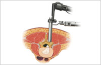 microscopic or endoscopic