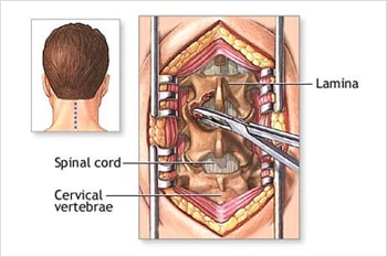 spinal cord